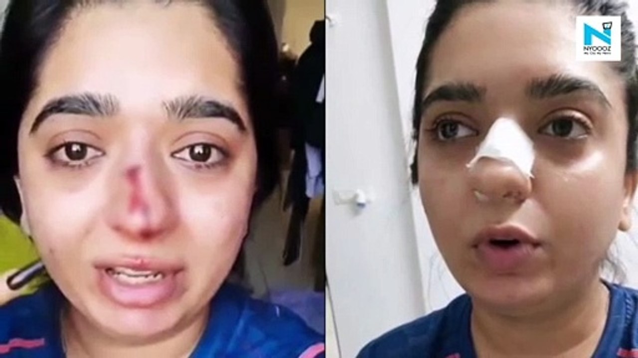Zomato delivery man files FIR against Bengaluru woman over assault row
