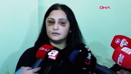 Скачать видео: Samsun’da eski eşinin dövdüğü kadın: Şiddet sessiz kalındıkça çoğalıyor