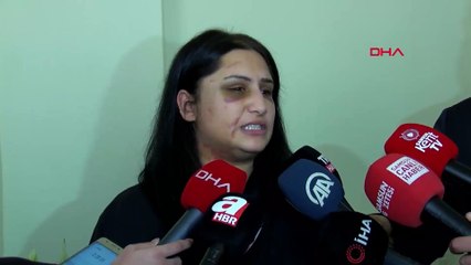 Samsun'da eski eşinin dövdüğü Emriye Metegül: Şiddet sessiz kalındıkça çoğalıyor