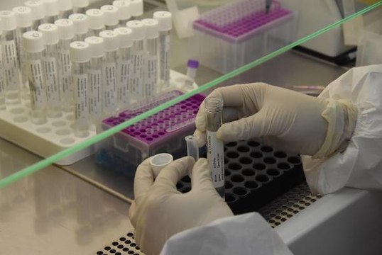 GENETİK HASTALIKLAR ANNE KARNINDA BİR KAN TESTİYLE BELİRLENEBİLİYOR