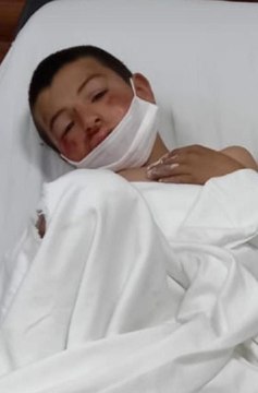 Son dakika... Yola fırlayan çocuk otomobilin altında kalarak yaralandı