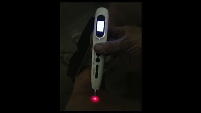 I am Using ,Millie Ng's, Hong Kong, physical therapist,, Mike row nano currents, knitting Techique, Aided By, a Separate, Acupoint Electro acupuncture, electronic acupuncture,e- acupuncture, pen come on the radio locator come on, Meridian locator, acupoi