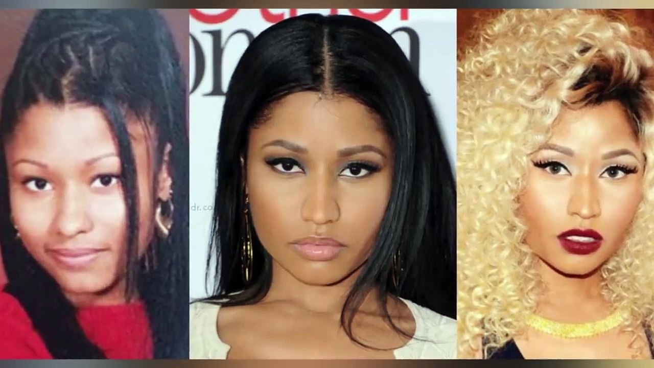 Did Nicki Minaj Get Plastic Surgery? Transformation Photos