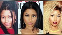 NICKI MINAJ _ Before and After Transformation ( Plastic Surgery, Makeup and More )