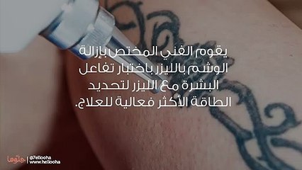 إزالة الوشم بالليزر وأضرار إزالة التاتو بالليزر