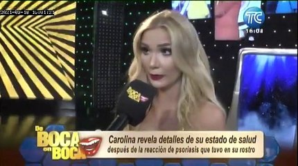 "Me ha deprimido muchísimo”: Carolina Jaume habla de su enfermedad