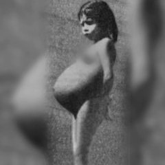 The Shocking Story Of Lina Medina, a 5-Year-Old Girl, Who Gave Birth