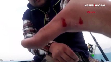 Canlı yayında zehirli balıkla temas hastanelik etti