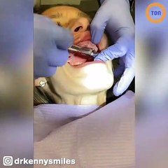 Cette ancienne toxicomane a la dentition foutue va recevoir un nouveau sourire