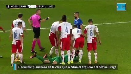 El terrible planchazo en la cara que recibió el arquero del Slavia Praga