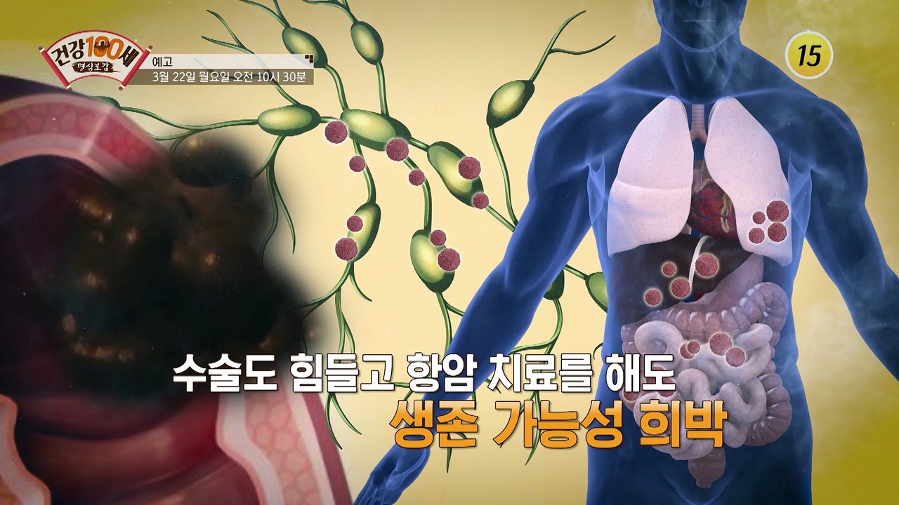백세까지 건강하게 살려면 장내 세균에 집중하라!_명심보감 31회 예고 TV CHOSU...