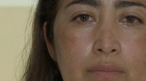 Impunidad, el temor de víctimas de ataques con ácido en Colombia