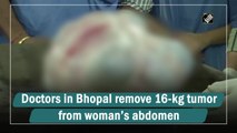 Doctors in Bhopal remove 16-kg tumour from woman’s abdomen