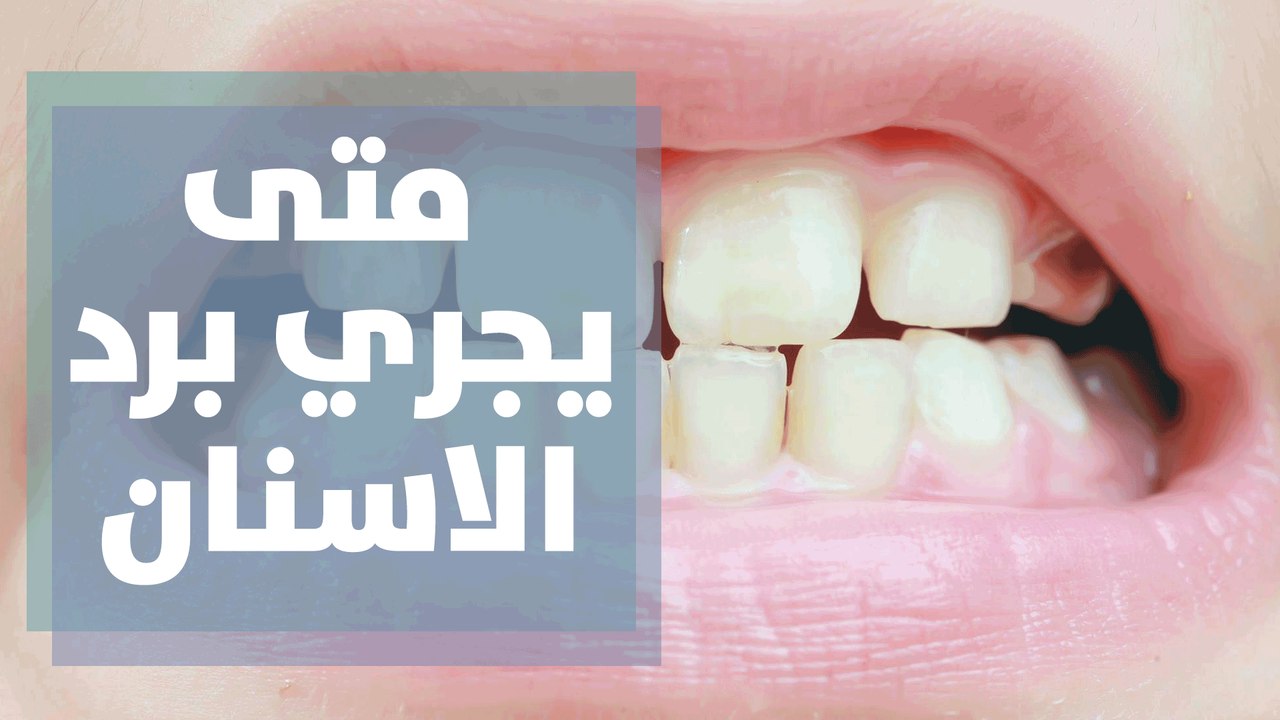 متى يجري برد الاسنان