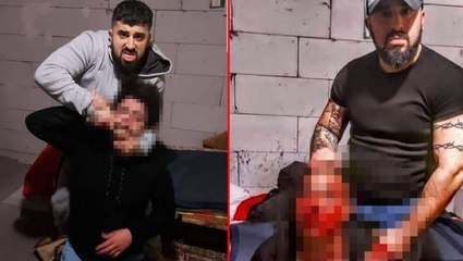 Fırat Kaya'nın acımasızca dövdüğü işitme engelli gencin darp vidosunu çeken kişi açığa alındı