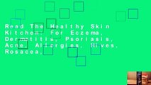 Read The Healthy Skin Kitchen: For Eczema, Dermatitis, Psoriasis, Acne, Allergies, Hives, Rosacea,