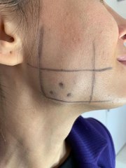 PANDEMİ DÖNEMİNDE STRESE BAĞLI OLARAK DİŞ SIKMA ORANI ARTTI