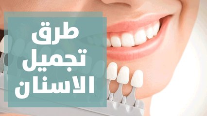 أحدث طرق تجميل الاسنان