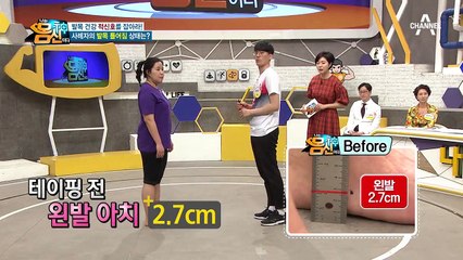 테이핑만 했을 뿐인데... 곧바로 효과가 나타난 '발목 테이핑'