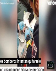 Los bomberos utilizan una sierra de precision para retirar un anillo atascado en el dedo de un nino