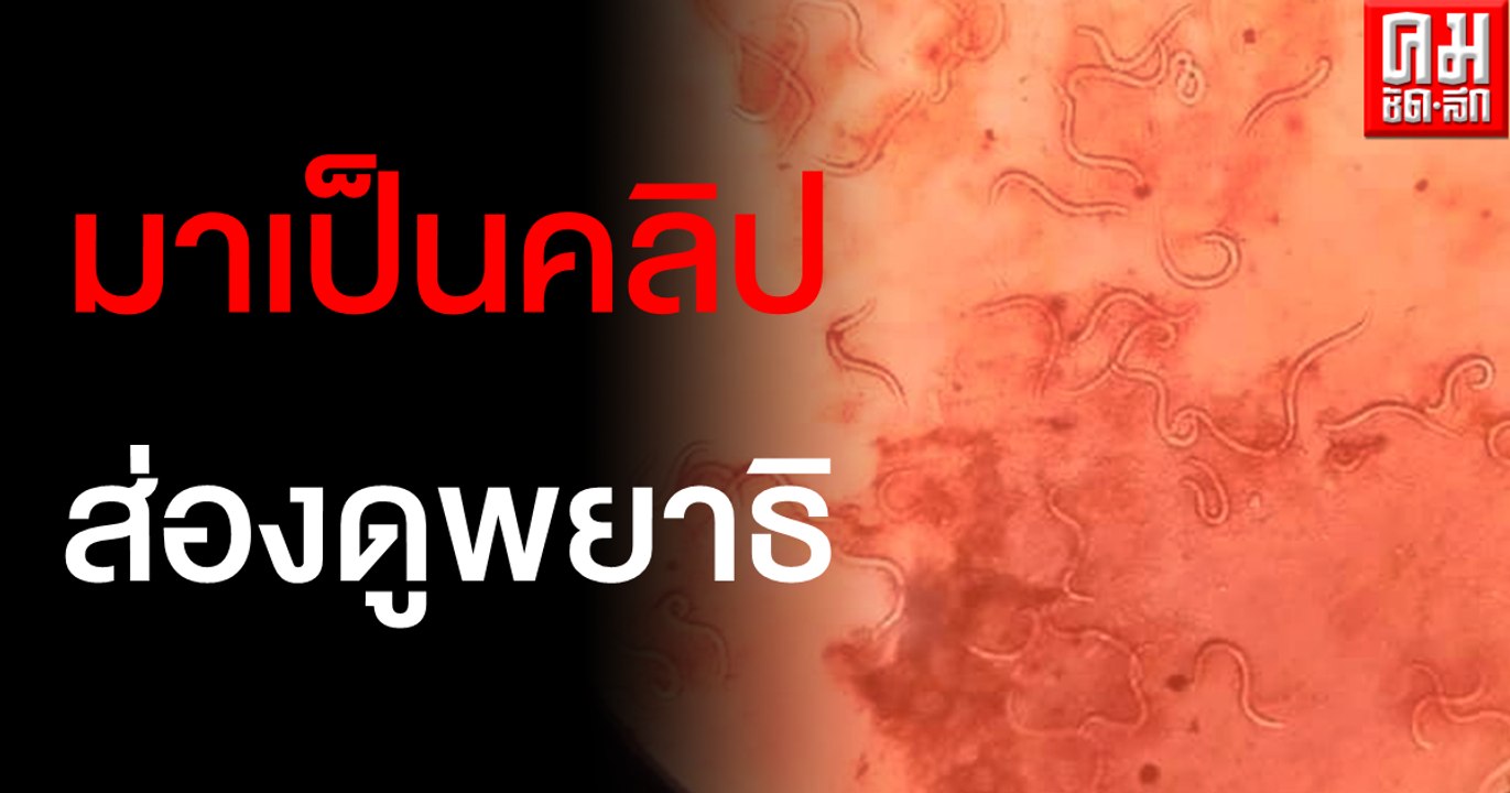 "พยาธิสตรองจิลอยด์" เมื่อส่องด้วยกล้องจุลทรรศน์
