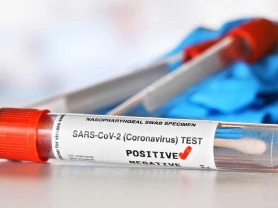 Inzidenz steigt: RKI meldet mehr als 22.600 Corona-Neuinfektionen