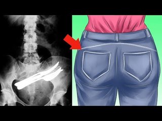 5 HAL PALING MENGEJUTKAN YANG TERTANGKAP X-RAY BANDARA