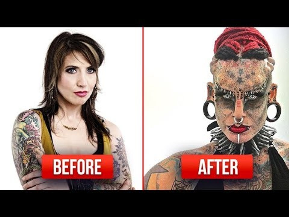 5 OPERASI PLASTIK PALING MENGERIKAN YANG PERNAH TERJADI