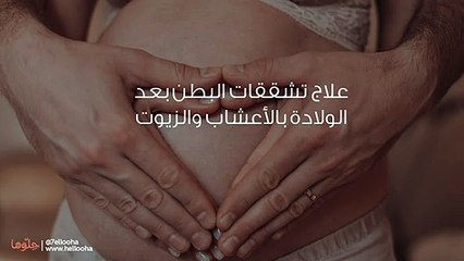 علاج تشققات البطن بعد الولادة بالأعشاب والزيوت