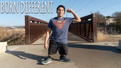 I Was Born With No Thighs | BORN DIFFERENT
