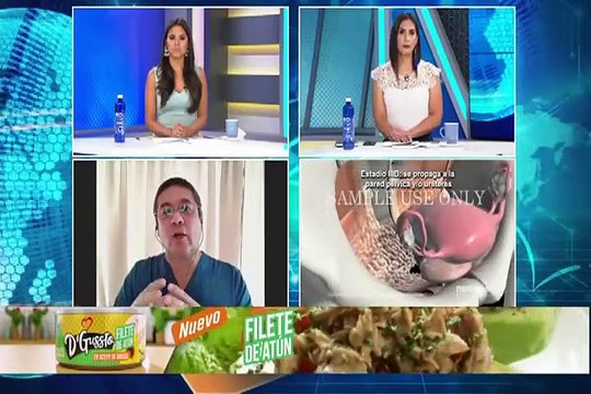 Sepa cómo detectar a tiempo el cáncer de cuello uterino