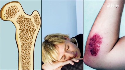 الأسئلة الشائعة حول الأثار الجانبية للعلاج الكيميائي