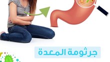 جرثومة المعدة: أهم التفاصيل