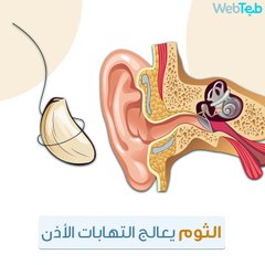 الثوم .. وما أدراك ما الثوم!