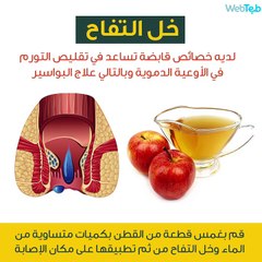 طرق فعالة وطبيعية لعلاج البواسير