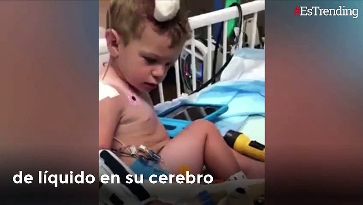 Davey Reid, el niño con la cabeza del tamaño de un adulto