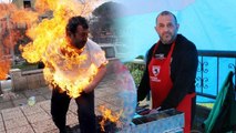 O ‘dehşet fotoğraf’taki kişi konuştu: Ateşe yaklaşamıyorum