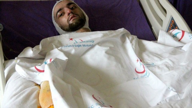 Banyo yapmak için sobaya benzin döktü, feci şekilde yandı