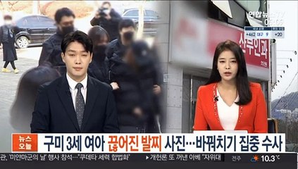 구미 3세 여아 끊어진 발찌 사진 확보…바꿔치기 집중수사