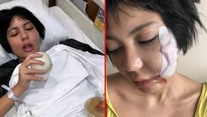 Bahar Candan'ın yüzünü yaralayan kişi serbest bırakıldı, Twitter'dan destek mesajı yağdı