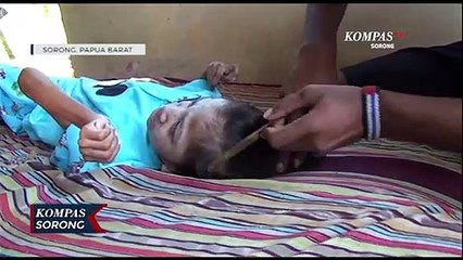 Lumpuh Sejak Lahir, Sinta Butuh Perhatian