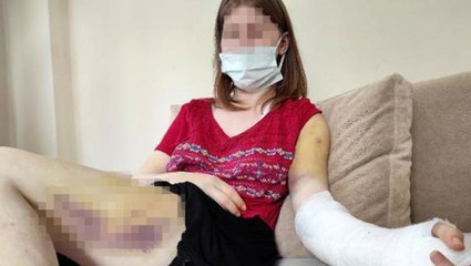 Erkek arkadaşının beyzbol sopasıyla dövdüğü kadın, korkunç geceyi anlattı