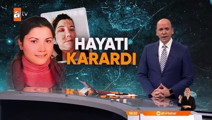 Ameliyattan sonra bu hale geldi