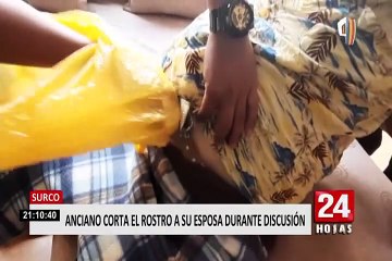 Surco: detienen a violento sujeto que agredió y desfiguró rostro de su conviviente