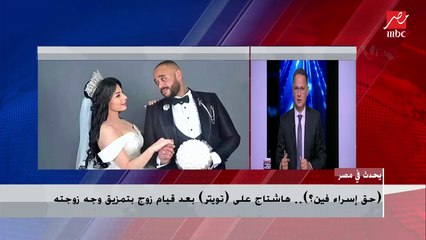 حق إسراء فين .. هاشتاج على تويتر.. بعد قيام زوج بتمزيق وجه زوجته