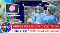 Sức khỏe của bạn: Những tiến bộ của y học trong phẫu thuật cắt Amidan