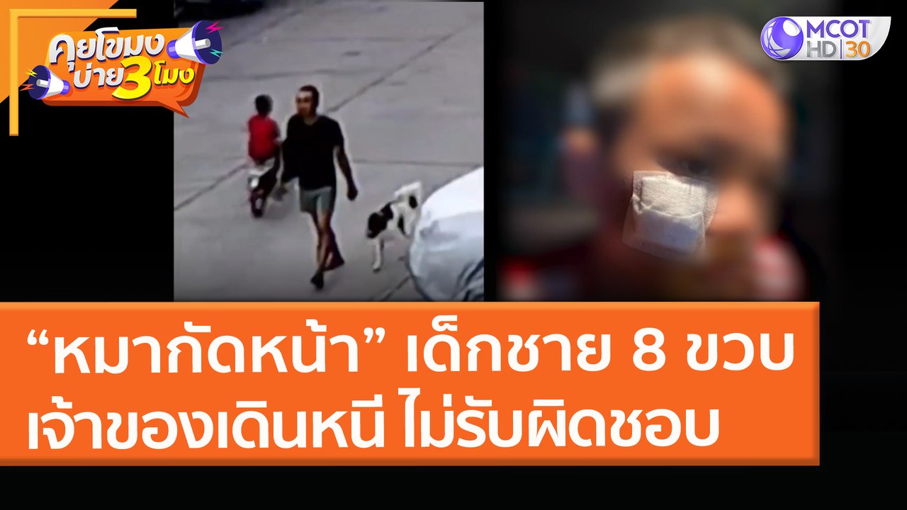 “หมากัดหน้า” เด็กชาย 8 ขวบ เจ้าของเดินหนี! ไม่รับผิดชอบ (31 มี.ค. 64) คุยโขมงบ่าย 3 โมง
