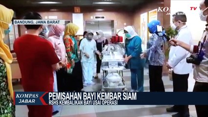 RSHS Kembalikan Kembar Siam Usai Operasi Pemisahan