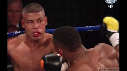 Boxer reveals on Instagram images of her completely mangled face