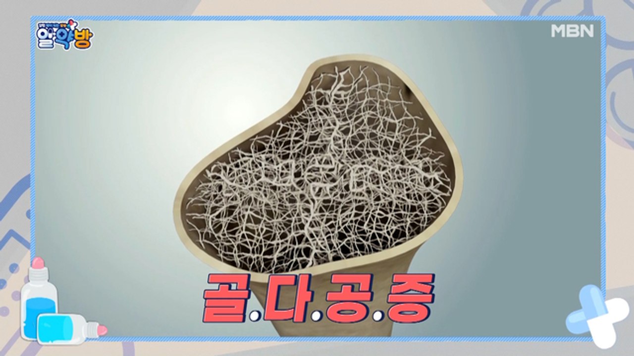 알약방 40회 [작은 충격에도 骨(골) 骨(골)! 중년 여성들의 뼈 건강을 위협하는...